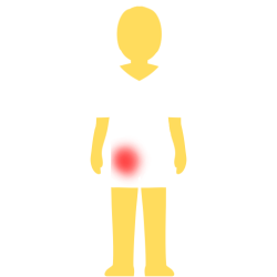 A person with no hair or face, an emoji yellow skintown, and a white pair of shorts and pants with no visible divider between the two. there's a glowing red spot on their left pelvis.